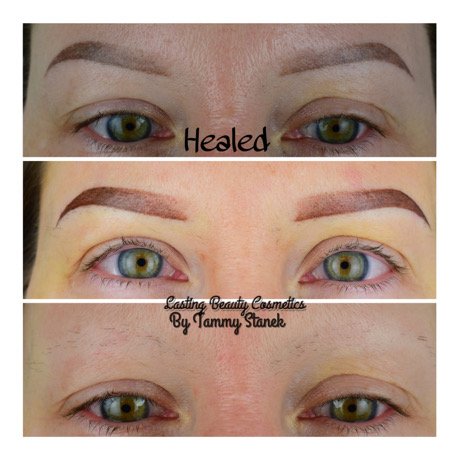 Healed Powder Brow Alopecia 